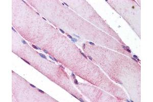 Immunohistochemistry (IHC) image for anti-Selenoprotein N, 1 (SEPN1) (C-Term) antibody (ABIN2773903)