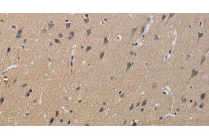 Immunohistochemistry of paraffin-embedded Human brain using KCNMB4 Polyclonal Antibody at dilution of 1:40 (KCNMB4 anticorps)