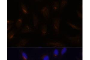 Immunofluorescence analysis of U-2 OS cells using FoxO3a Polyclonal Antibody at dilution of 1:100. (FOXO3 anticorps)