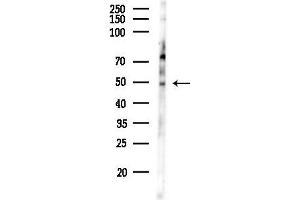 Western blot analysis of lysates from PC12 cells(LPS,4h treatment), using HAPLN1 Antibody at 1/1000 dilution.