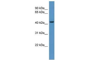 WB Suggested Anti-B4galt6 Antibody Titration:  0. (B4GALT6 anticorps  (C-Term))