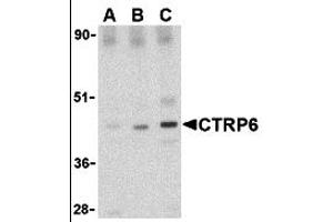 Western Blotting (WB) image for anti-Complement C1q Tumor Necrosis Factor-Related Protein 6 (C1QTNF6) (Middle Region) antibody (ABIN1030915) (CTRP6 anticorps  (Middle Region))