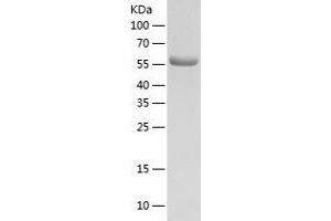 Lysyl-tRNA Synthetase (KARS) (AA 63-597) protein (His tag)