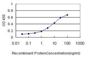 Detection limit for recombinant GST tagged MTUS1 is approximately 0.