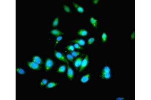 Immunofluorescent analysis of Hela cells using ABIN7142079 at dilution of 1:100 and Alexa Fluor 488-congugated AffiniPure Goat Anti-Rabbit IgG(H+L) (PHPT1 anticorps  (AA 1-125))