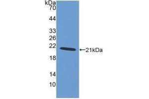 Detection of Recombinant AIF1, Human using Polyclonal Antibody to Ionized Calcium-binding Adapter Molecule 1 (IBA1)
