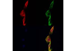 EIF2G/EIF2S3 Antibody staining Hela cells by IF/ICC.