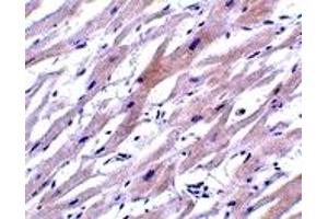 Immunohistochemistry (IHC) image for anti-Uracil-DNA Glycosylase (UNG) (N-Term) antibody (ABIN1031654)