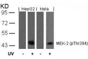 Image no. 2 for anti-Mitogen-Activated Protein Kinase Kinase 2 (MAP2K2) (pThr394) antibody (ABIN196622) (MEK2 anticorps  (pThr394))