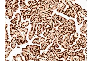 Immunohistochemistry analysis using Rabbit Anti-Wnt5a Polyclonal Antibody (ABIN5651131).