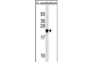 TAGLN3 Antibody (N-term) (ABIN1538865 and ABIN2849905) western blot analysis in mouse cerebellum tissue lysates (35 μg/lane). (Transgelin 3 anticorps  (N-Term))