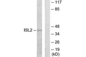 Western blot analysis of extracts from 293 cells, using ISL2 Antibody. (ISL2 anticorps  (AA 161-210))