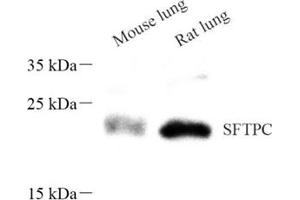 Western blot analysis of sftpc (ABIN7075216),at dilution of 1: 600 (Prosurfactant Protein C anticorps)