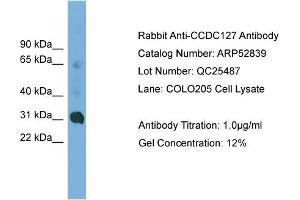 WB Suggested Anti-CCDC127  Antibody Titration: 0. (CCDC127 anticorps  (N-Term))