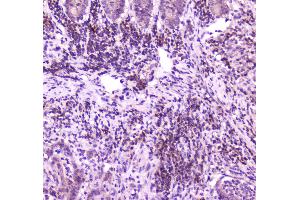 anti-Phospholipase C gamma 2 (PLCG2) (AA 1201-1258) antibody