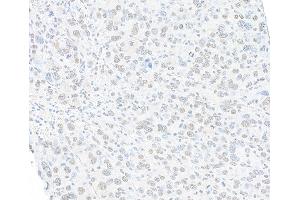 Immunohistochemistry (IHC) image for anti-Structural Maintenance of Chromosomes 1A (SMC1A) (C-Term) antibody (ABIN7455193) (Recombinant SMC1A anticorps  (C-Term))