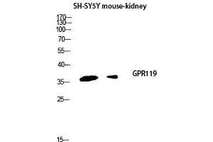 Western Blot (WB) analysis of SH-SY5Y Mouse Kidney lysis using GPR119 antibody. (G Protein-Coupled Receptor 119 anticorps  (Internal Region))