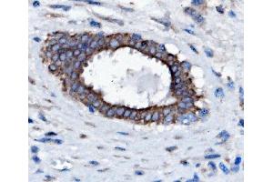 IHC analysis of Slc25a1 using anti-Slc25a1 antibody (ABIN7602839).