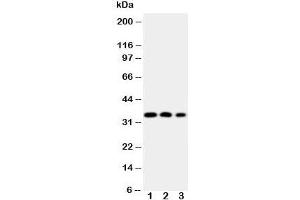Western blot testing of HOXA4 antibody and Lane 1:  SW620;  2: SW620;  3: PC-12 cell Nuclear lysate (HOXA4 anticorps  (N-Term))