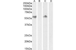 (ABIN185563) (2 μg/mL) staining of Human Lymph node (A) + peptide (B) and Tonsil (C) + peptide (D) lysate (35 μg protein in RIPA buffer) Detected by chemiluminescence.