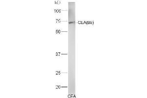 Human CEA lysates probed with Mouse Anti-CEA (B5) Monoclonal Antibody, Unconjugated (bsm-1624M) at 1:300 overnight at 4˚C. (CEA anticorps)