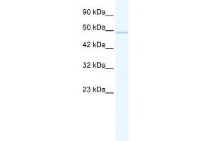 WB Suggested Anti-ZNF276 Antibody Titration:  1. (ZNF276 anticorps  (Middle Region))