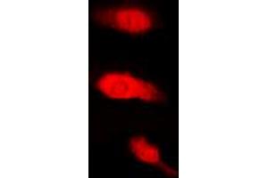 Immunofluorescent analysis of HuB staining in K562 cells. (HuB (Center) anticorps)