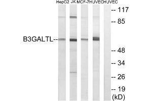 Western blot analysis of extracts from HepG2 cells, Jurkat cells, MCF-7 cells and HUVEC cells, using B3GALTL antibody. (B3GALTL anticorps  (C-Term))