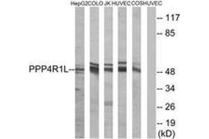 Western blot analysis of extracts from COLO/HuvEc/HepG2/Jurkat/COS cells, using PPP4R1L Antibody. (PPP4R1L anticorps  (AA 191-240))