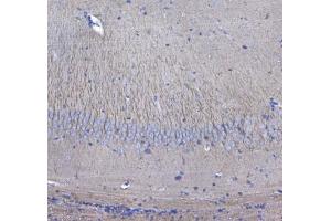 IHC testing of FFPE mouse brain tissue with GSTM3 antibody at 1ug/ml. (GSTM3 anticorps)