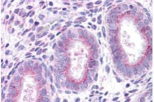Human Uterus: Formalin-Fixed, Paraffin-Embedded (FFPE) (XCR1 anticorps  (C-Term))