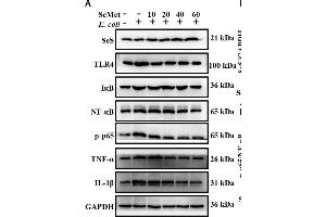 SeMet reversed activation of TLR4/NF-κB pathway induced by ESBL-E. (NF-kB p65 anticorps  (pSer536))