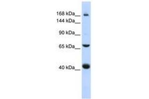 Image no. 1 for anti-ATP-Binding Cassette, Sub-Family C (CFTR/MRP), Member 9 (ABCC9) (AA 1440-1489) antibody (ABIN6740836) (ABCC9 anticorps  (AA 1440-1489))