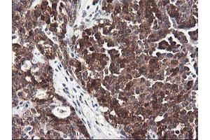 Image no. 6 for anti-F-Box Protein 21 (FBXO21) antibody (ABIN1498232) (FBXO21 anticorps)