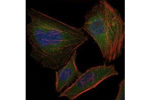 Immunofluorescence analysis of HeLa cells using TNNI2 monoclonal antobody, clone 2F12G2  (green). (TNNI2 anticorps)