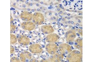 Immunohistochemistry of paraffin-embedded Mouse kidney using SND1 Polyclonal Antibody at dilution of 1:100 (40x lens). (SND1 anticorps)