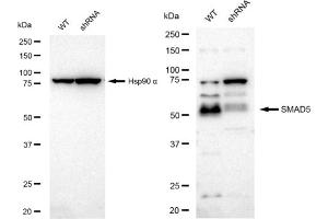 Western blotting analysis using SMAD5 antibody (ABIN7800374). (Recombinant SMAD5 anticorps)