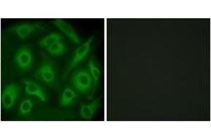 Immunofluorescence analysis of HeLa cells, using CDH23 Antibody. (CDH23 anticorps  (AA 61-110))
