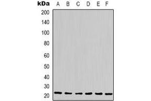 Western blot analysis of Cyclophilin B expression in Hela (A), Jurkat (B), 293T (C), HepG2 (D), NIH3T3 (E), rat liver (F) whole cell lysates.