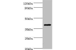 Western blot All lanes: HDAC11 antibody at 2 μg/mL + Mouse brain tissue Secondary Goat polyclonal to rabbit IgG at 1/10000 dilution Predicted band size: 40, 34 kDa Observed band size: 40 kDa (HDAC11 anticorps  (AA 1-347))