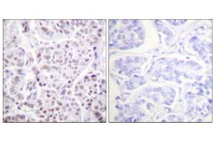 A-peptide - + (Histone H4 anticorps  (acLys5))