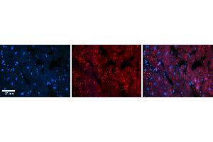 Rabbit Anti-INSR Antibody   Formalin Fixed Paraffin Embedded Tissue: Human Heart Tissue Observed Staining: Cytoplasm in cardiomyocytes Primary Antibody Concentration: 1:100 Other Working Concentrations: 1:600 Secondary Antibody: Donkey anti-Rabbit-Cy3 Secondary Antibody Concentration: 1:200 Magnification: 20X Exposure Time: 0.