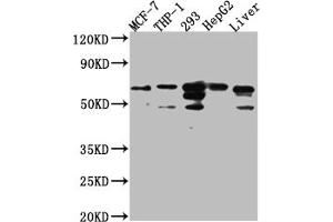 Western Blot Positive WB detected in: MCF-7 whole cell lysate, THP-1 whole cell lysate, 293 whole cell lysate, HepG2 whole cell lysate, Mouse Liver whole cell lysate All lanes: FAAH1 Antibody at 1:1000 Secondary Goat polyclonal to rabbit IgG at 1/50000 dilution Predicted band size: 64 kDa Observed band size: 64 kDa (Recombinant FAAH anticorps)