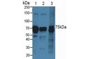 Figure. (Cadherin 5 anticorps  (AA 69-391))