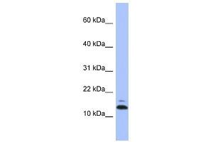 ASAH1 antibody used at 1 ug/ml to detect target protein. (ASAH1 anticorps)