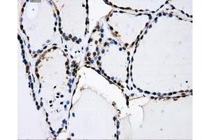 Immunohistochemical staining of paraffin-embedded Kidney tissue using anti-PKMYT1mouse monoclonal antibody. (PKMYT1 anticorps)
