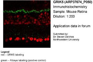Sample Type: Mouse RetinaPrimary Dilution: 1:200 (GRIK5 anticorps  (Middle Region))
