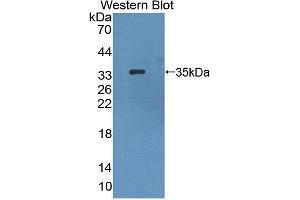 Detection of Recombinant HPS1, Mouse using Polyclonal Antibody to Hermansky Pudlak Syndrome Protein 1 (HPS1) (HPS1 anticorps  (AA 1-275))