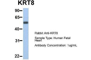 Host:  Rabbit  Target Name:  KRT8  Sample Type:  Human Fetal Heart  Antibody Dilution:  1. (KRT8 anticorps  (Middle Region))