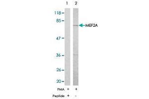 Western blot analysis of extract from NIH/3T3 , using MEF2A polyclonal antibody  .
